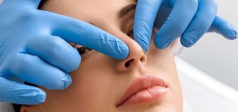 Синдром пустого носа: когда дыхание есть, а воздуха «нет»